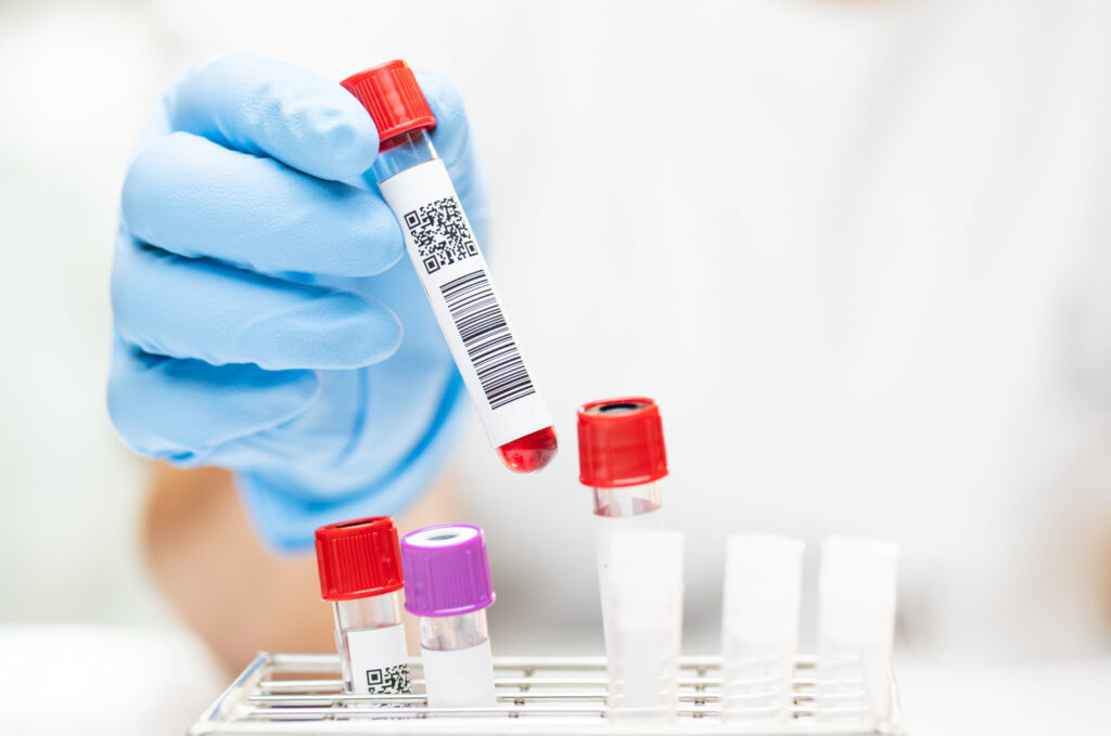 como se llevan a cabo los análisis de inmunología